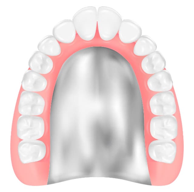 コバルト床義歯